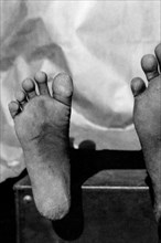 africa, congo belga, la dimensione di un piede pigmeo è 17,4 cm, 1927 1930