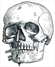 Skull from a woman.