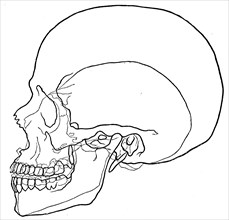 Microcephalic skull.