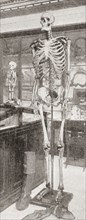 The skeletons of Charles Byrne.