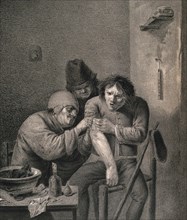 surgeon dresses the wound of a grimacing patient, Wounds and injuries, treatment in 17th century