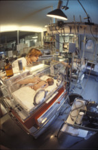 Surveillance of premature babies, children's clinic Zurich 1982