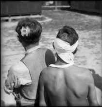 Spanish refugees; injured repatriates; head injury; 1945.