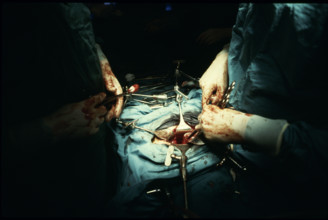 Operation with 'Octopus' assistant device 1980
