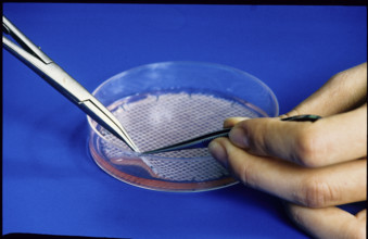 Skin cell culture in petridish 1989