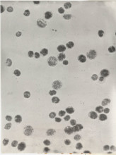 Glenodinium sanguineum