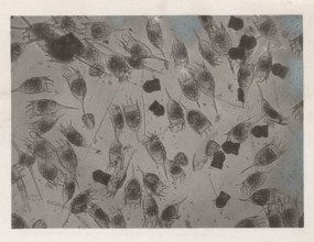 Keratella cochlearis and Codonella lacustris