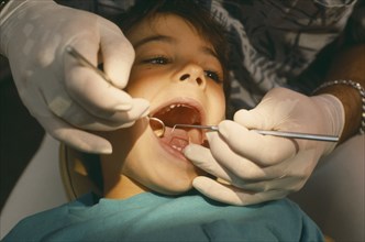 HEALTH, Dentistry, Dentist examining child with mouth wide open
