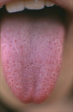 HEALTH, Taste, Close view of childs tongue showing taste buds.