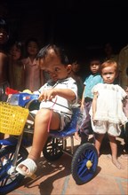 VIETNAM, Tan Bien, Child victim of Agent Orange chemical.