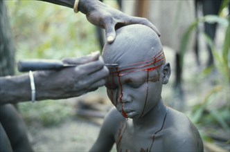 SUDAN, Scarification, "Dinka initiation into manhood.  Scarring ceremony in which each boy has six