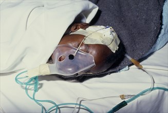 BOTSWANA, Children, Dehydrated infant on drip and wearing oxygen mask.