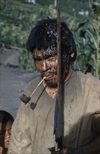 COLOMBIA, Sierra de Perija, Yuko - Motilon ., "Victim after a ritual bow fight in which aim is to