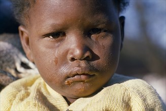 SOUTH AFRICA, Gauteng, Soweto, "Portrait of young child with dirty, tear stained face and sores