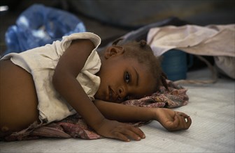 ZAMBIA, Mayukwayukwa Camp, Child lying on mattress in day feeding centre for malnourished children