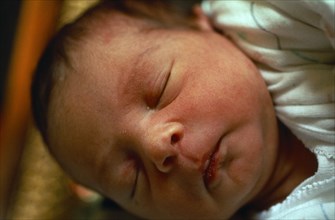 Children, Babies, New Born, Five day old babygirl with puffy eyelids.