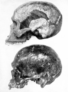 Skull of Piltdown man