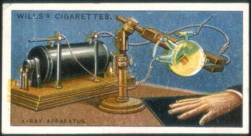 X-ray apparatus powered by a Ruhmkorff coil being used to take an X-ray of a hand