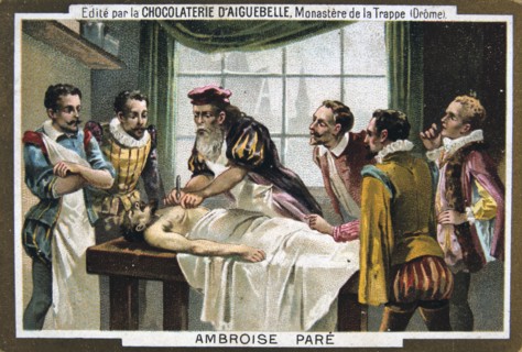 Ambroise Pare