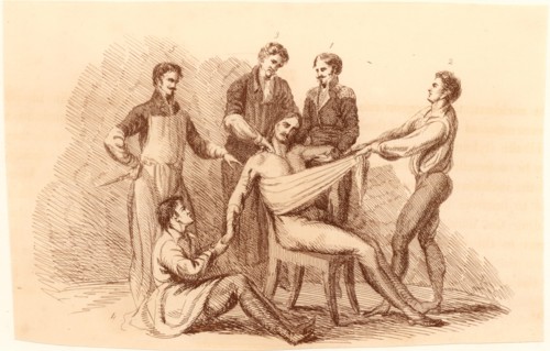 Surgeon and his assistants, before the introduction of anaesthetics