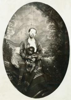 African woman with white skin due to lack of Melanin