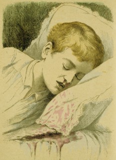 Boy with Haemophilia