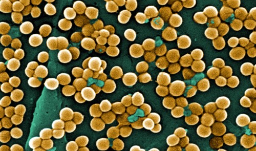 MRSA Virus under a microscope