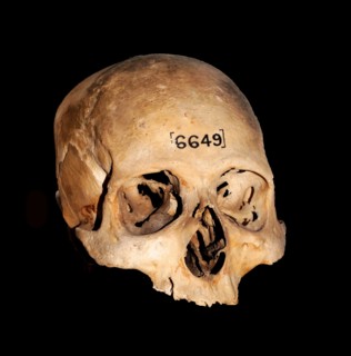 Ancient Egyptian Skull 600-300 BC, 26th Dynasty or later