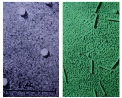 Influenza virus taken through a microscope