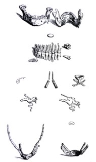 Plates from the First Book of the De Humani Corporis Fabrica by Vesalius