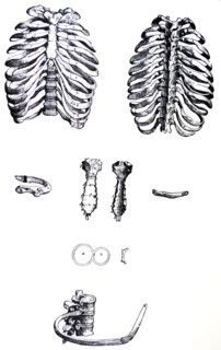 Plates from the First Book of the De Humani Corporis Fabrica by Vesalius