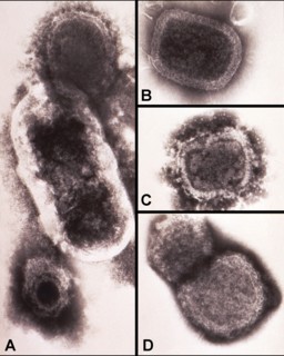 electron micrograph (TEM) revealing some of the ultrastructure morphology exhibited by a number of different microorganisms