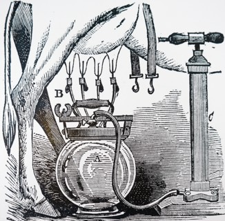 A milking machine invented by Edward M