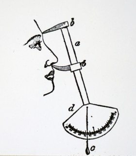 A clinometer used for measuring angles of the profile of a face