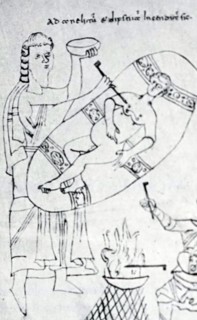 Illustration depicting a medieval surgical operation