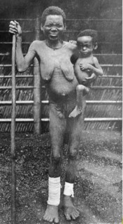 Deutsch-Ostafrika / Bevoelkerung : Expedition von Robert Koch zur Untersuchung der Schlafkrankheit 1906-1907
