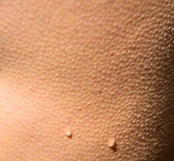 Goose bumps with drops of water