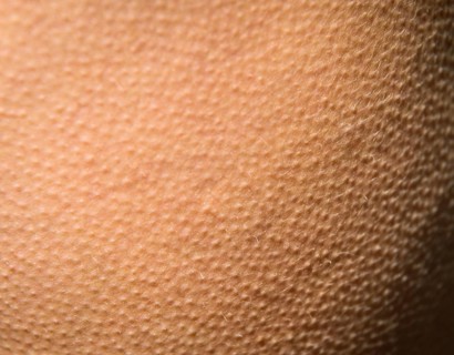 Goose bumps