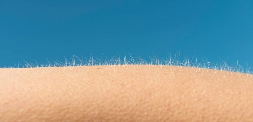 Goosebumps