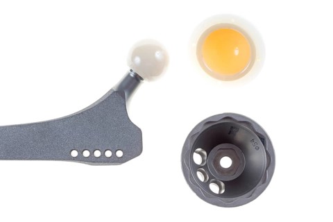 Endoprosthesis