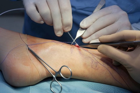 Operation