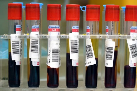 Blood samples in medical laboratory