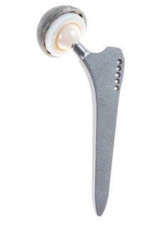 Endoprosthesis