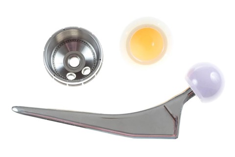Endoprosthesis