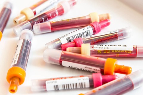 Blood samples
