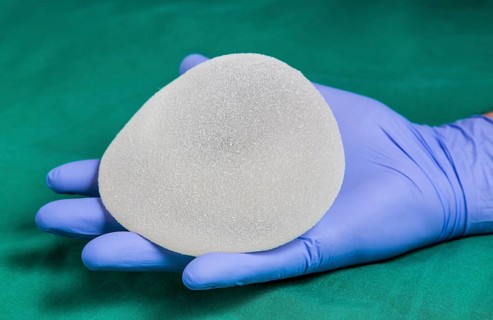 Silicone breast implant