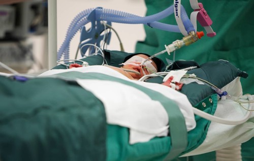 Surgery of a newborn
