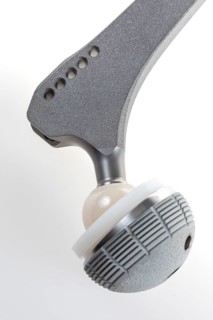 Endoprosthesis