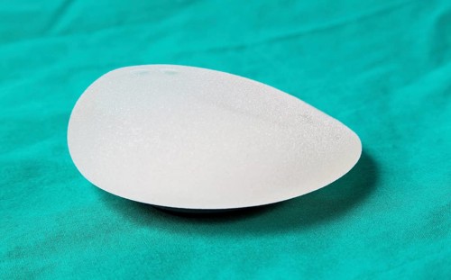 Silicone breast implant