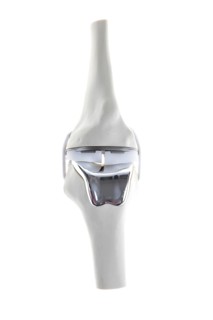 Knee prosthesis